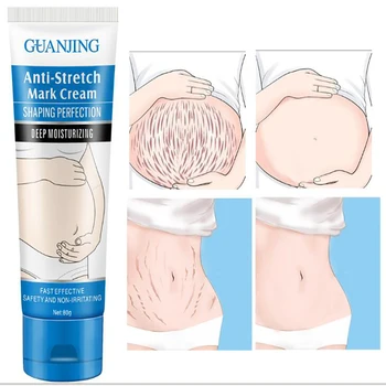 

Stretch Marks Remover Essential Oil Skin Care Treatment Cream For Stretch Mark Removal Maternity Slackline For Pregnant Oils 80g