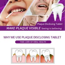 

12 Tabs Professional Oral Hygiene Dental Teeth Plaque Disclose Dental Indicator Bacterial Plaque Disclosing Tablet