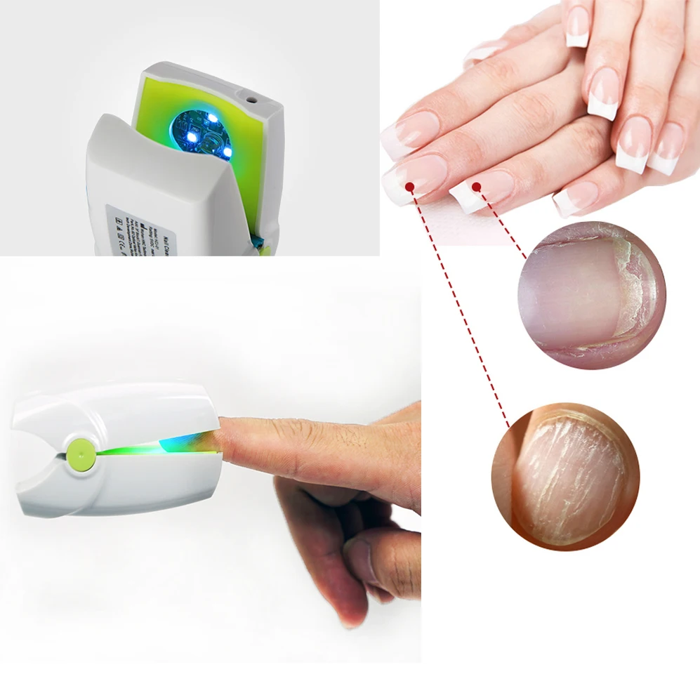 Nail Fungus Light Therapy Device Professional Toe Finger Fungal Cure Stop Grey Infection Treatment Machine | Красота и здоровье