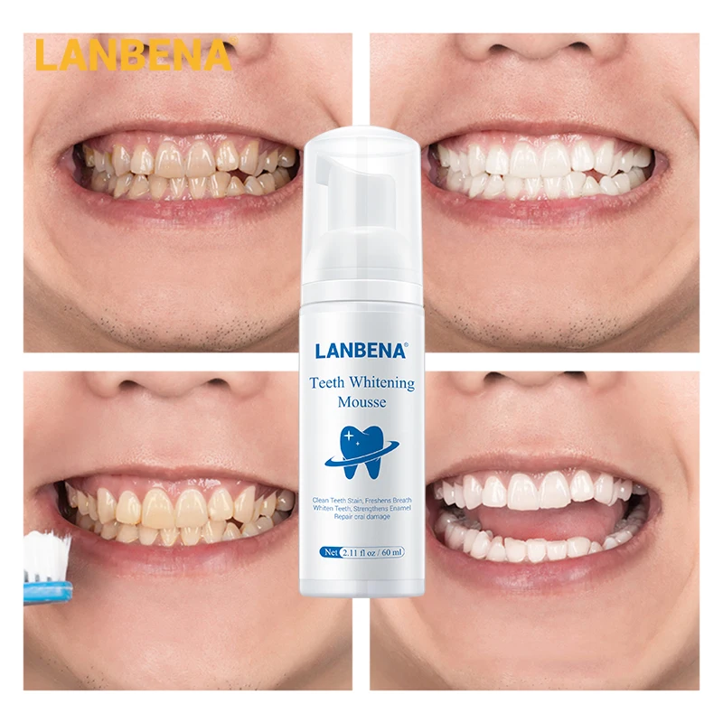 Зуб отбеливание пить. LANBENA Teeth Whitening Mousse. Teeth Whitening Mousse от LANBENA. Мусс для очищения зубов LANBENA Teeth Whitening Mousse. Отбеливающий мусс Teeth Whitening Mousse от LANBENA, 60 Г.