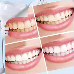 Экологически чистые эффективные чистящие пруты для зубов бытовые портативные удаление пятен уход за полостью рта Y1