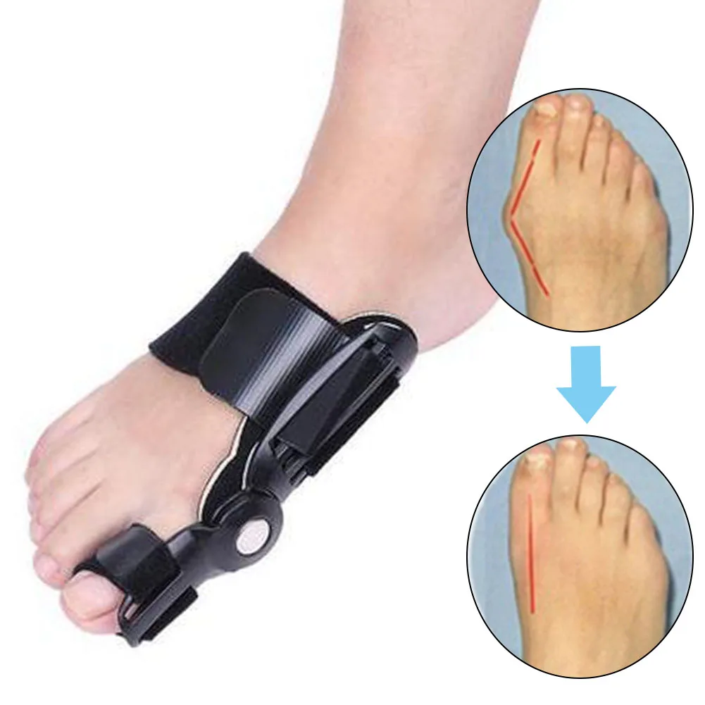 Pain Relief Foot Care Corrector Belt Correction Tool Bunion Splint Straightener Hallux Valgus Big Toe Foot Corrector Adjustable