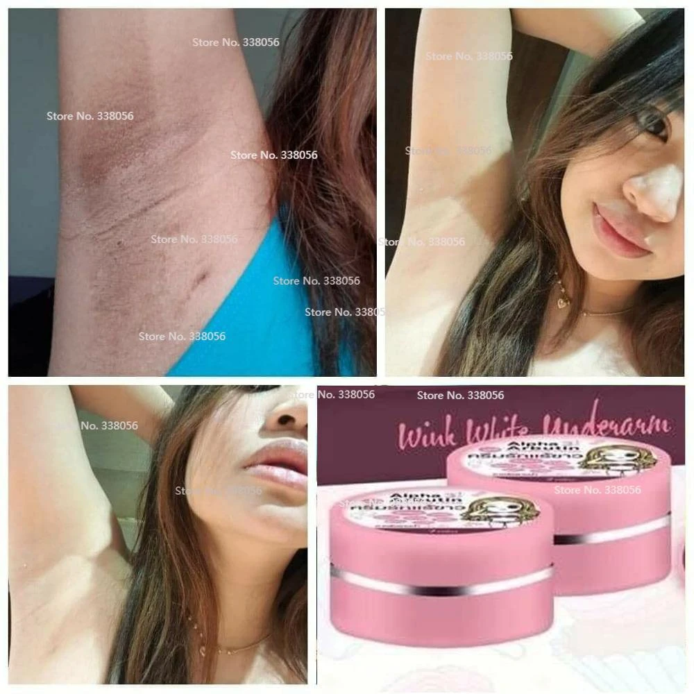 glycolic acid arbutin