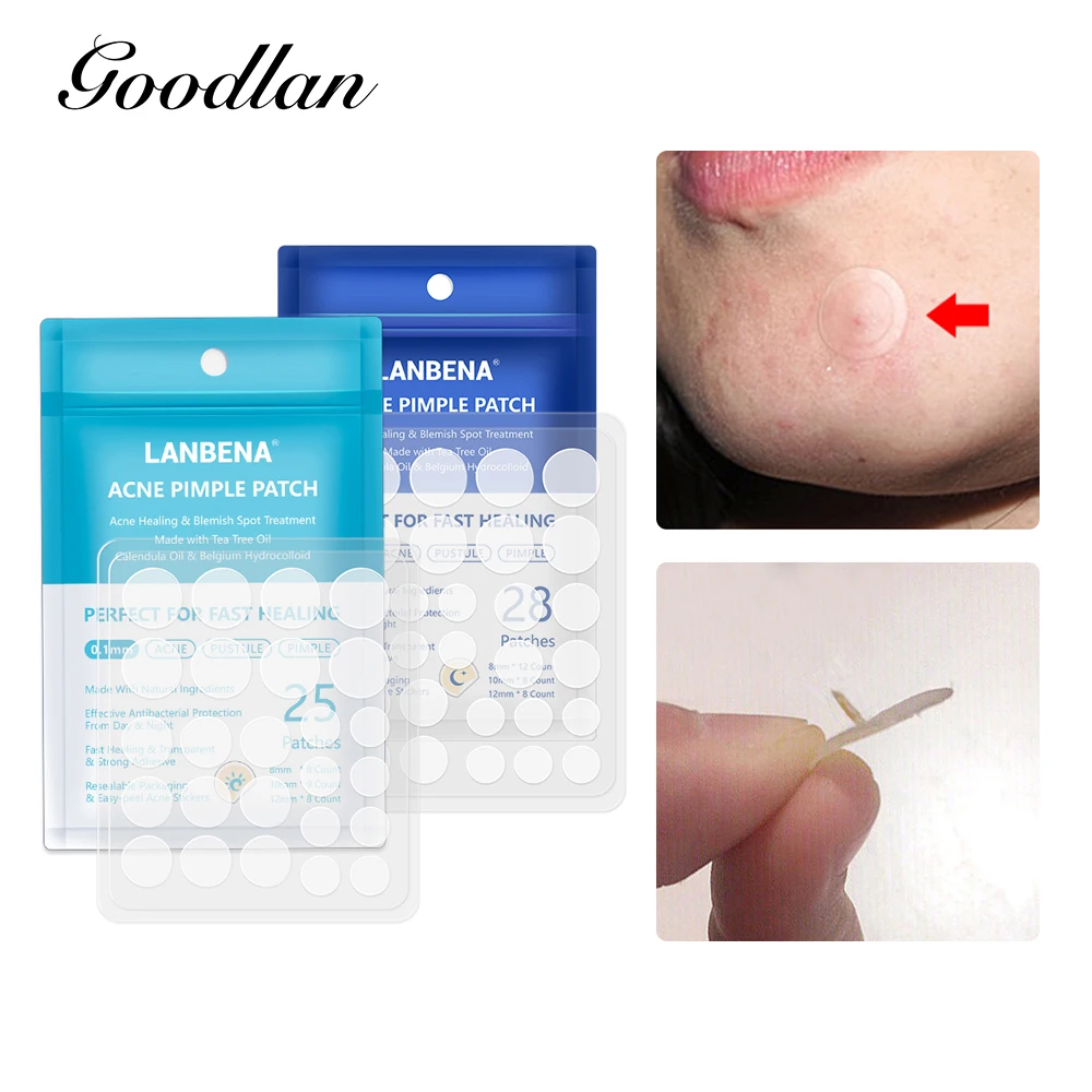

LANBENA Acne Removal Patch Acne Treatment Mask Anti Acne Stickers Blackhead Pimple Remover Face Cream Facial Tool Skin Care