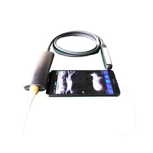 

USB Port Handheld Ultrasound Machine for windows tablet windows PC and android smartphone