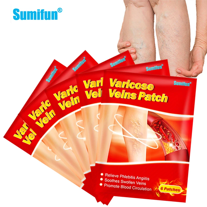 12/30Pcs Varicose Veins Treatment Patch Varicosity Angiitis Remedy