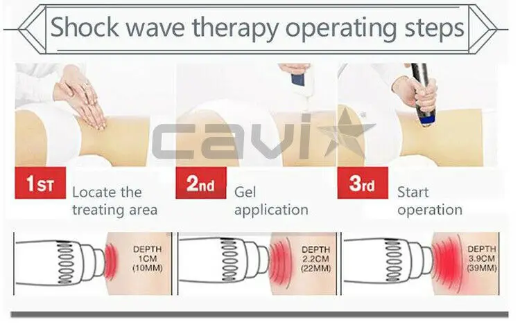 Портативная Ударная Волна Shockwave терапия ED лечение/боли в суставах Одобрено CE
