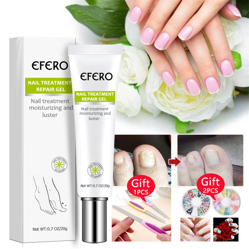Nail Fungus Repair Treatment Cream Onychomycosis Paronychia Anti Fungal