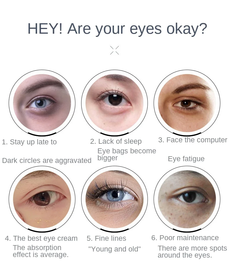 Terapia de Luz Cuidados com os Olhos Portátil Elétrica Aquecida Vibração Olho Beleza Massagem Caneta Rugas Remover Massageador Vermelha Ferramenta Alívio Fadiga 10 Beleza e saúde