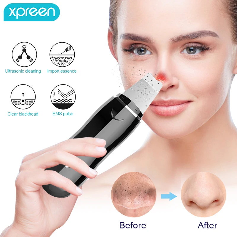 

Professional Ultrasonic Facial Skin Scrubber Deep Face Cleaning Peeling Rechargeable Skin Care Device Beauty Instrument