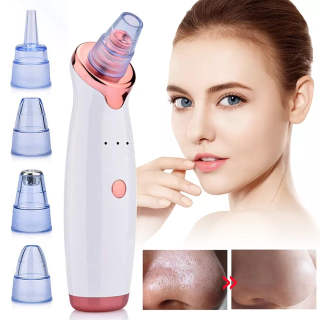 pore cleanser vacuum blackhead remover