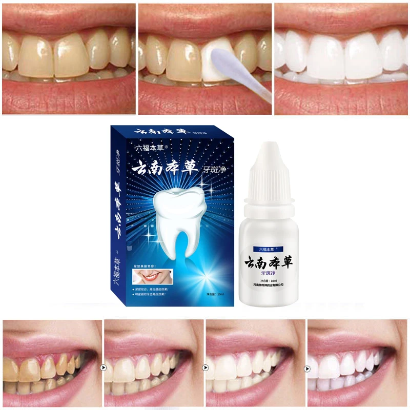 Teeth whitening 50 grams remove smoke stains coffee stains tea stains fresh breath bad breath oral