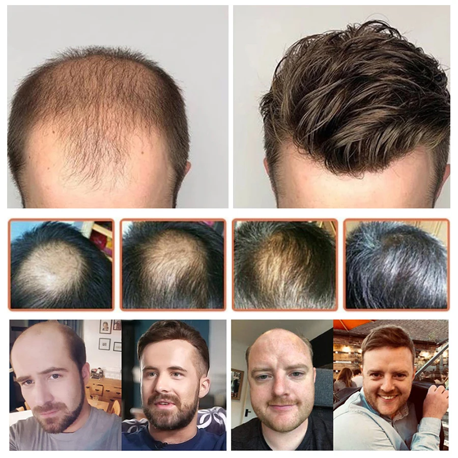 Human Hair Toupee Q6 Swiss Lace Front Men Prosthesis