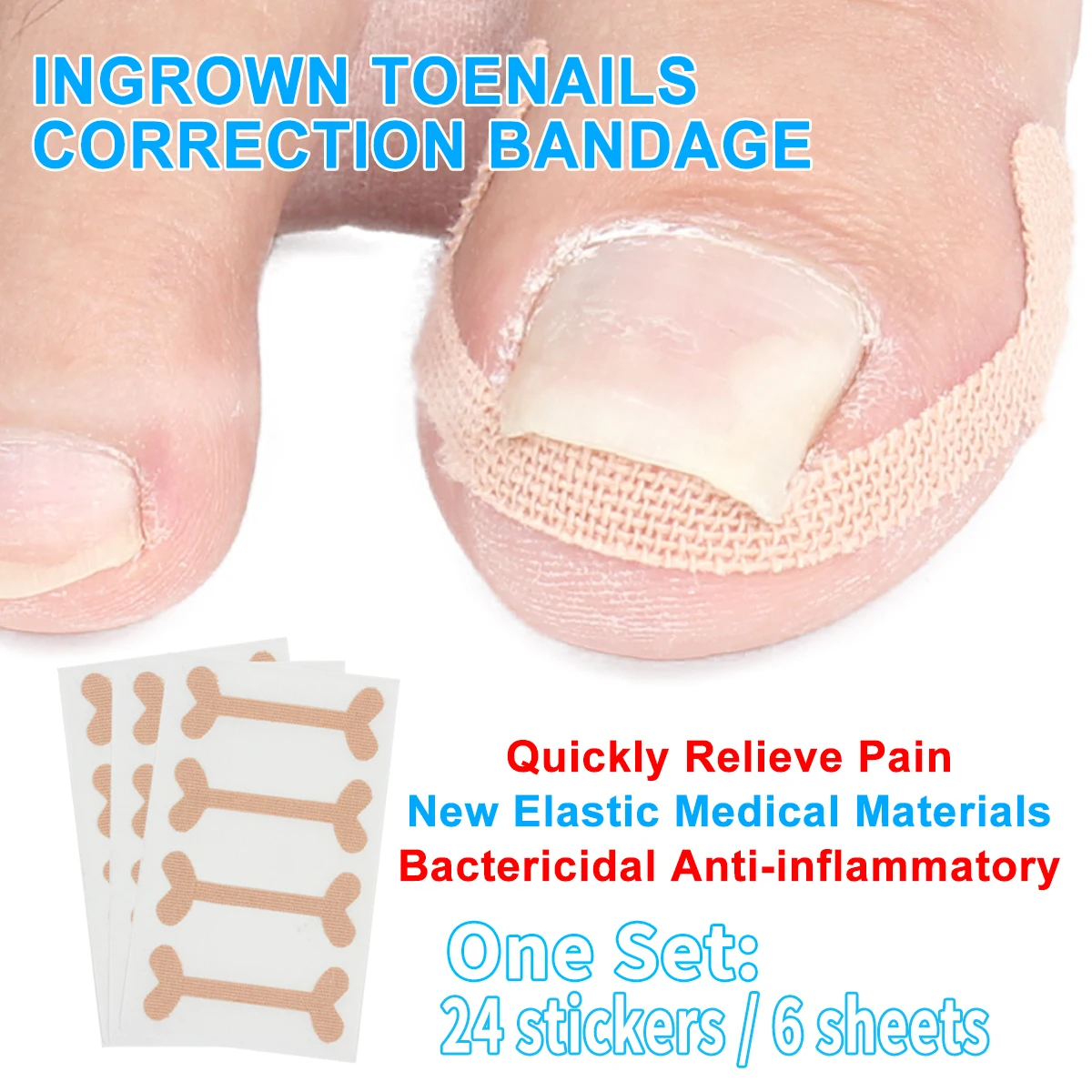 NonGlue Toenail Patch Ingrown Toenail Correction Pedicure Tool Buy Non