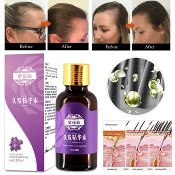 

20ml Hair Growth Serum Essential Oil Anti Preventing Hair Lose Dense Hair Fast Hair Growth Oil Liquid Ginger Hair Repair Growing