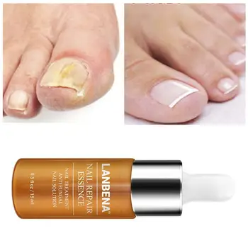 

Nail Oil Gel Fungus Onychomycosis Removal Treatment Liquid Repair Toe Q7S0