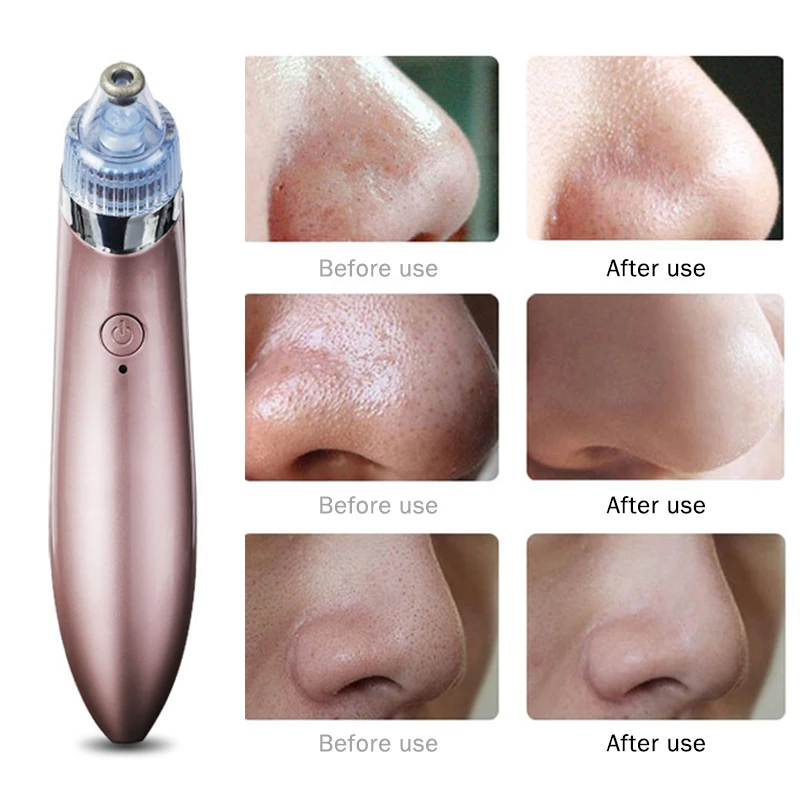 Электрический вакуумный отсос для угрей пор лица с 4 зондами удаления