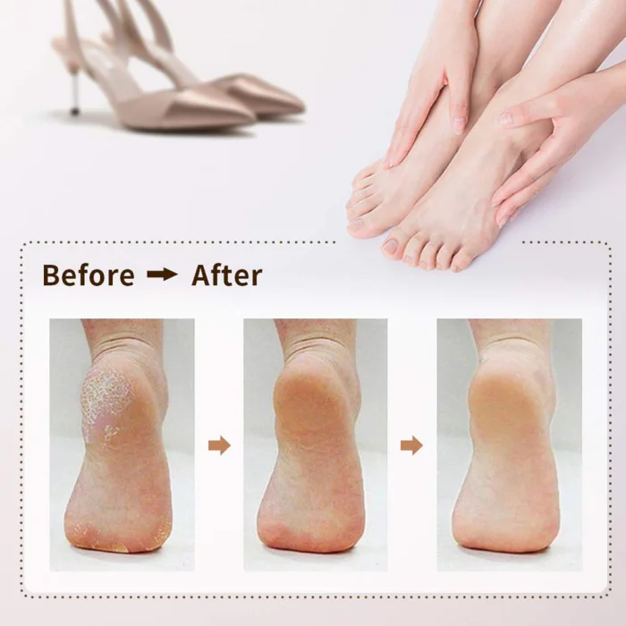 Newly Electronic Feet File Hard Skin Callus Remover Scrubber Home Pedicure Exfoliation Tool Rechargeable MS88
