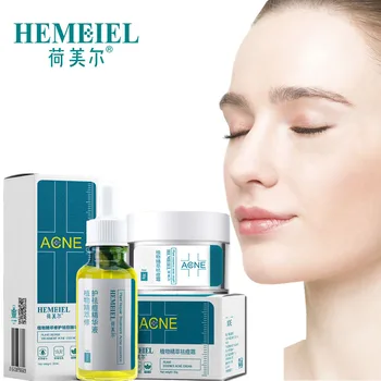 

Herbal Plant Extract Acne Treatment Set Acne Scar Removal Face Serum Cream Oil Control Shrink Pores Facial Serum Skin Care