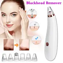 Инструмент для удаления черных точек для ухода за кожей отсосать черную головку артефакт Электрический Очиститель пор инструмент для красоты лица Черный экспортный инструмент