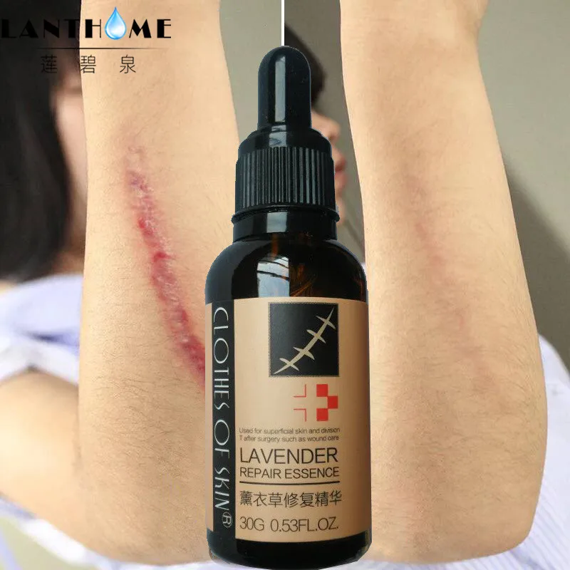 

LAIKOU Pure Natural Essential Oils Scar Removal Lavender Oil For Massage Pregnant Women Anti Acne Hyaluronic Acid Serum Face oil