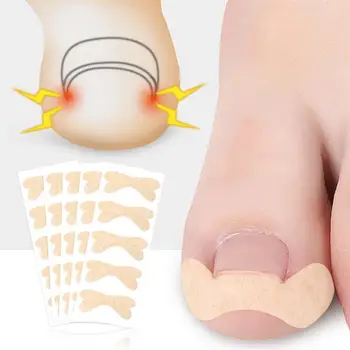 

25pcs Ingrown Toenail Correction Tool Toenail Treatment Corrector Stickers Pedicure Foot Toe Thumb Nail Care Patch Sticker