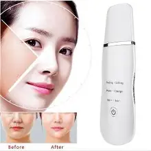 Deep Cleansing Skin Scrubber for Home Use Ion Face Beauty Device Wholesale Best Face Exfoliator Wrinkle Removal Pores