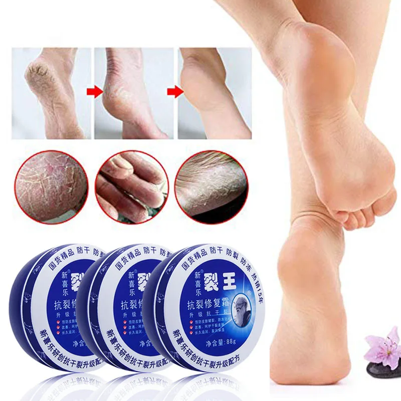 

88g Skin Anti-cracking Glicerina Repair Cream Dry Feet Cream Heel Balm Hand Moisturize Hand Cream Glycerin Anti-Dry Frostbite Itching Anti-freeze Foot Itching Medicine