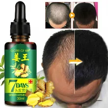 Essence-Oil Hair-Loss-Treatment Hair-Growth-Serum Ginger Germinal 7-Days for Women