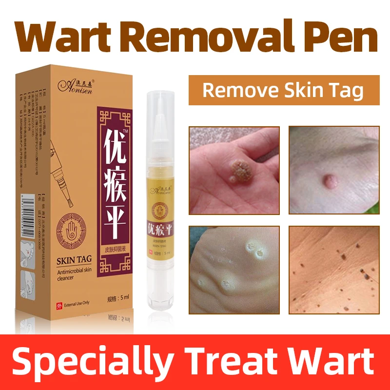 Body Flat Warts Remover Pen Meat Thorn Medical Ointment Liquid Skin Tag Mole Healthy Care Cream Patches Aliexpress 