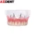 Зубная Модель Зубов Overdenture Съемная Внутренняя Нижняя Челюсть Модель Нижних Зубов Нижняя Челюсть с имплантатом для Обучения Зубам