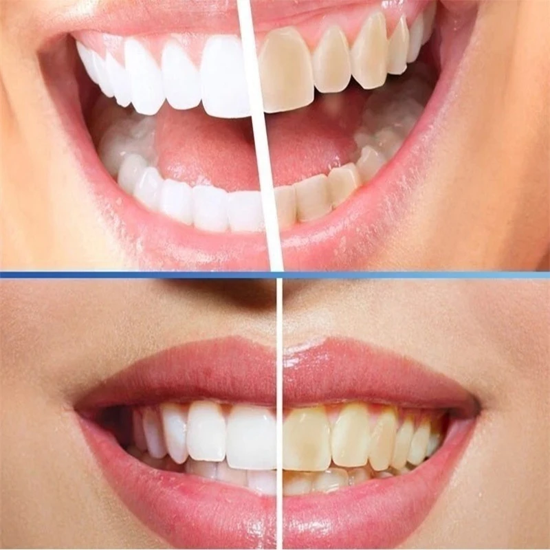 Tooth whitening tooth powder 100g, remove smoke stains, coffee stains, tea stains, freshen bad breath, oral hygiene, dental care