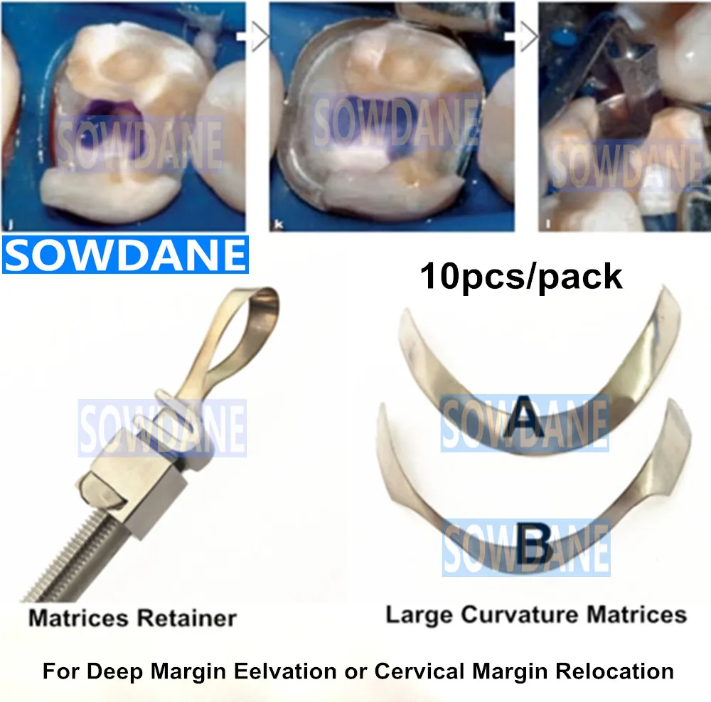 DentalTofflemireMatrixforDeepMarginElevationLargeCurvature