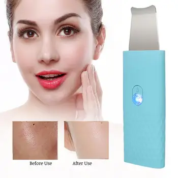 

Micro Needle Roller Mini Face Skin Scrubber Ultrasonic Cleanser Exfoliating Remove Blackheads Pore Cleanser Tool a