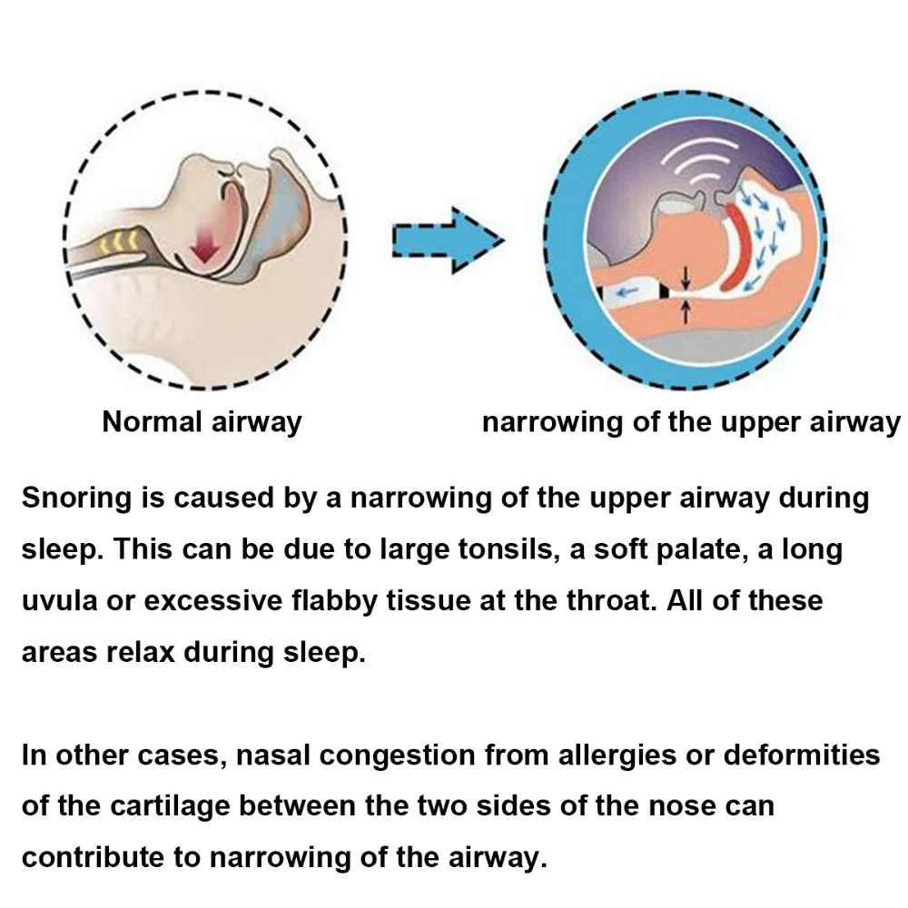 rB9kflje_i2ASFbcAAeZYPO96Pc086