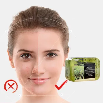 

Crystal Soap Cleaner Removal Pimple Pores Acne Treatment moisturizing face care wash basis for Inhibition of mite growth soap