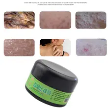 25g Pain Relief Natural Herbal Anti-Itch Cream Eczema Ointment Antibacterial Psoriasis Dermatitis Pruritus Medical Plaster