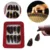 8 ШТ./Компл. Guzheng Picks Gu Zheng Nails Fingers With Box Over The Strings Аксессуары Для Музыкальных Инструментов