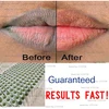 Lip care Of Lips Pink Fresh Lightening Bleaching Cream Treatment Remove Dark Smoke Lips lip oil 3