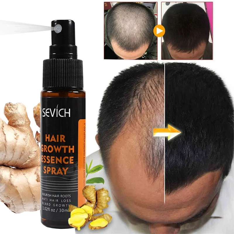 Espray de esencia para el crecimiento del cabello para hombres y mujeres, Gel para el crecimiento del cabello, anticaída de cabello, Germinal, nutre las raíces, fácil de llevar, 30ml