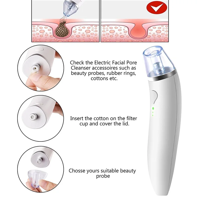 Средство для удаления черных точек для носа и лица, пылесос для удаления пор, электрический прибор для ухода за лицом в носу, глубокое очищение кожи, инструмент для красоты, Прямая поставка