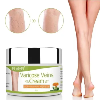 

50ml Varicose Vein Cream Ointment Vasculitis Angiitis Phlebitis Spider Veins Pain Remedy Herbal Body Cream Drop Shipping