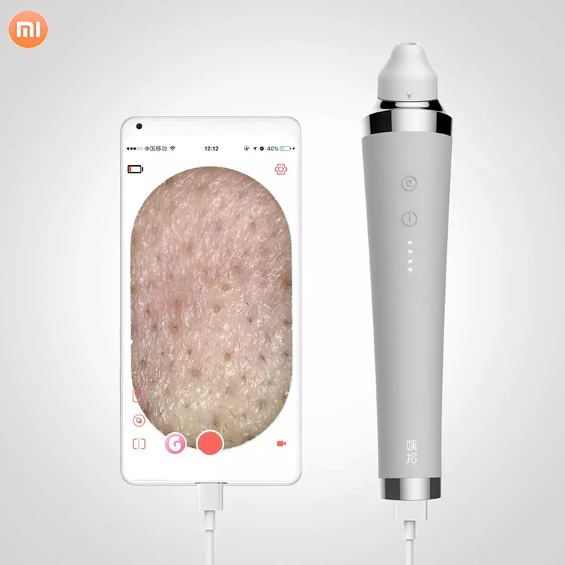 Xiaomi визуальное электрическое средство для удаления черных точек вакуумное