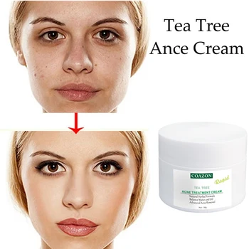

Acne Treatment Face Cream Tea Tree Essence Gel Remove Acnes Pimples Shrinking Pores Fade Marks Face Cream