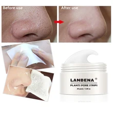 Маска для удаления угрей, маска для носа, полоска пор, черная маска, пилинг, маска для носа, полоска пор, пилинг, лечение акне, маски, красота, уход