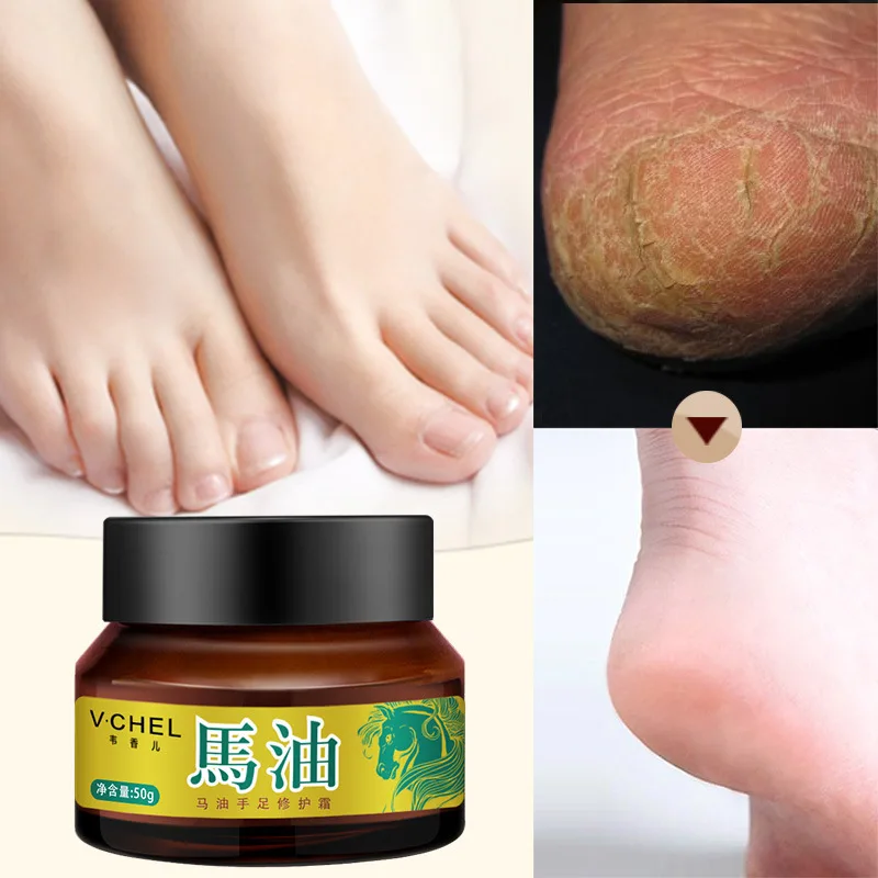 

Foot Repair Cream Moisturizing Nourishing Skin Anti-Drying Anti-Crack Heel Care Essential Cream For Hand And Foot