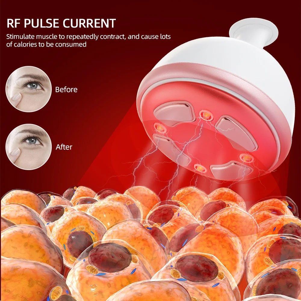 Вибрационный кавитационный массажер для похудения RF подтяжки кожи