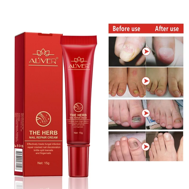

2020 Useful Herb Nail Repair Cream for Unisex Anti Fungal Nail Infection For Onychomycosis Paronychia Foot Care Cream Tools