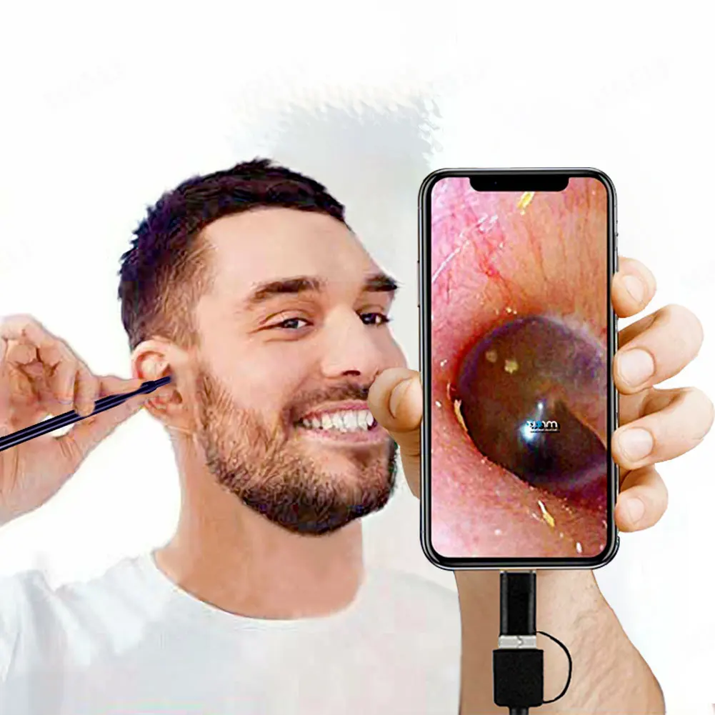 Cámara endoscópica para limpieza de oídos, endoscopio para teléfono móvil Android, USB C, Mini cámara endoscópica, otoscopio médico, PC Digital
