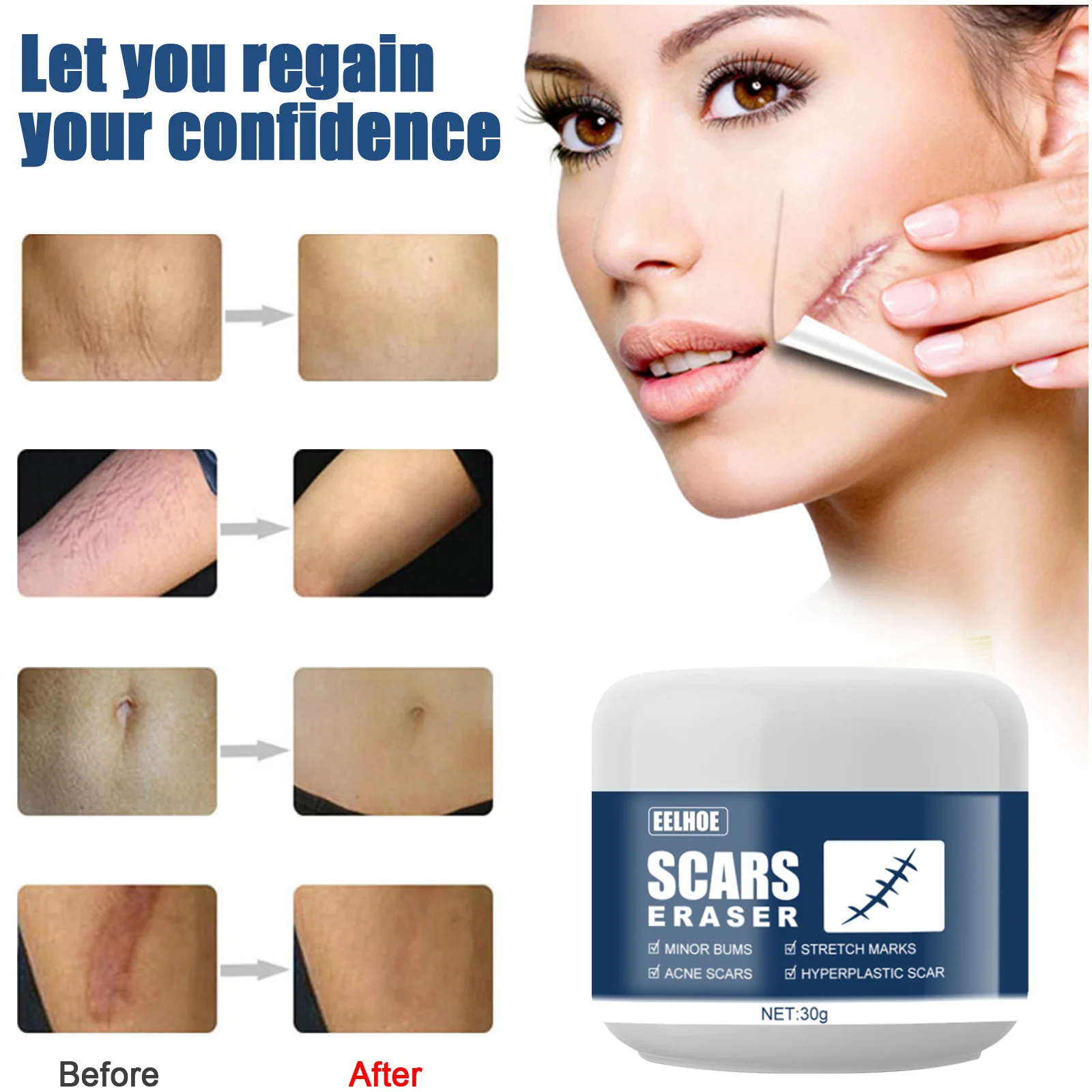 Advanced Treatment For Face & Body Old & New Scars From Cuts,stretch